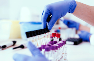 Image of someone's hands wearing latex gloves selecting a test tube from among several test tubes in a tray