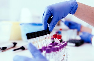 Person holding test tubes in a lab.